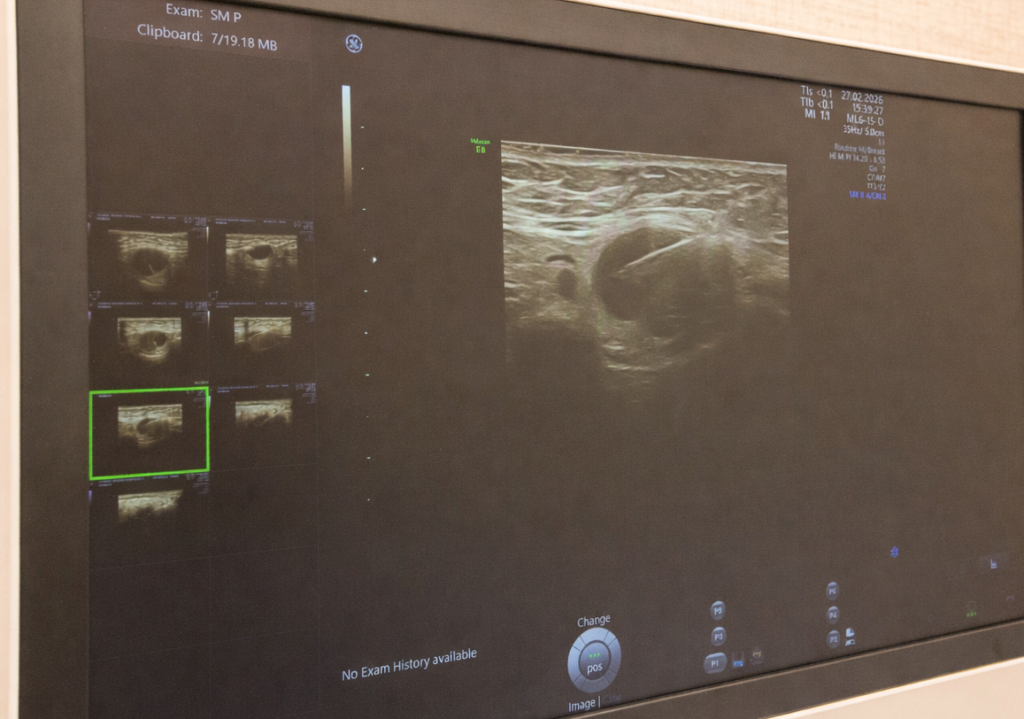 Ехограф GE Voluson 8