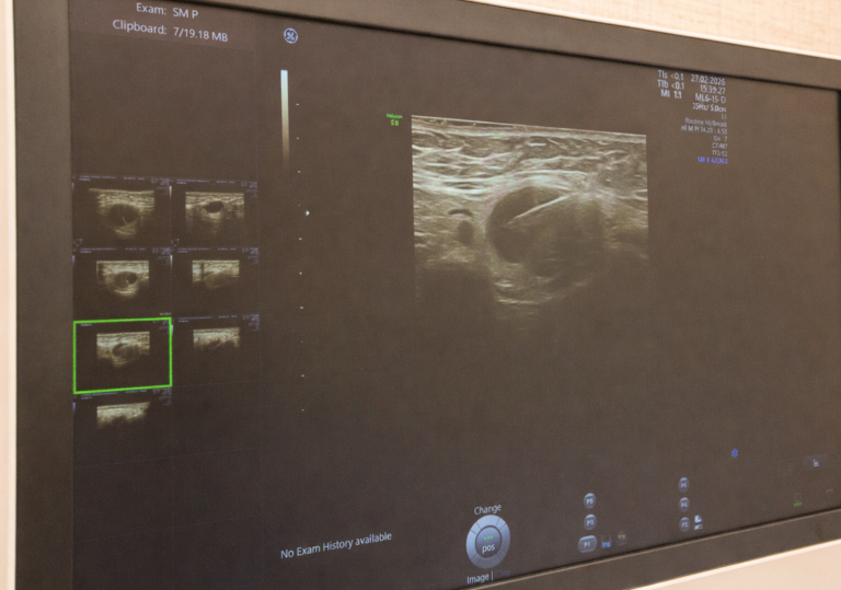 Ехограф GE Voluson 8